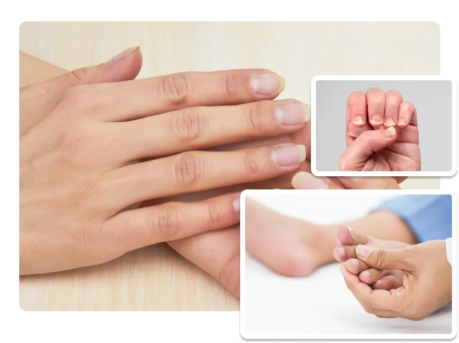 Nail Disorders_result