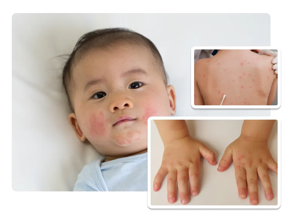 Paediatric Skin Diseases_result