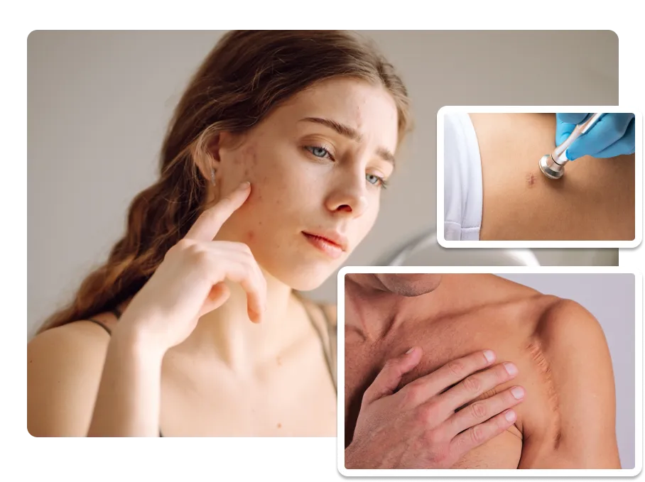 Scar Treatment_result