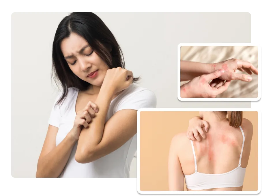 Skin Allergies_result