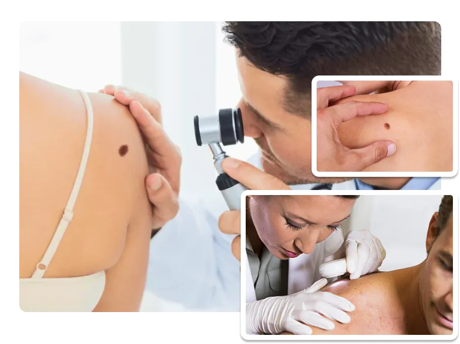 Skin Cancer Screening pic_1