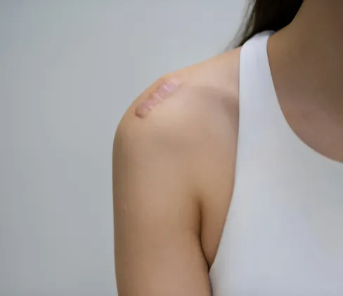 Advanced techniques to fade scars, smooth skin texture and improve overall appearance. 