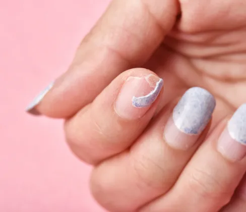Restoring the natural health and appearance of nails.