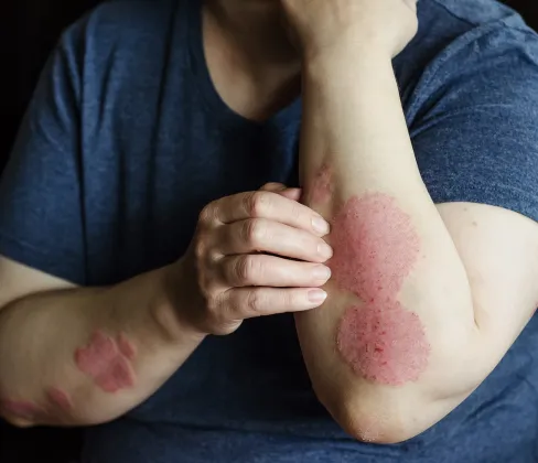 Long-term treatment strategies for healthier skin and improved comfort.