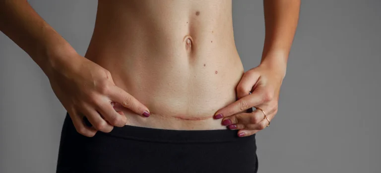Clinic-provided scar removal illustration