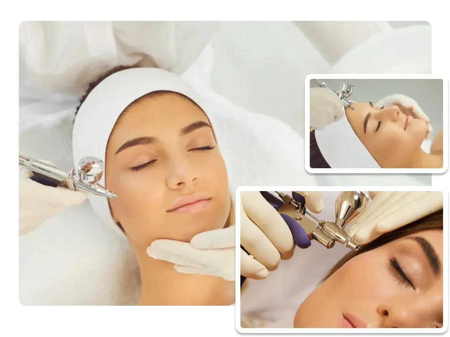 Oxygen Facial_result