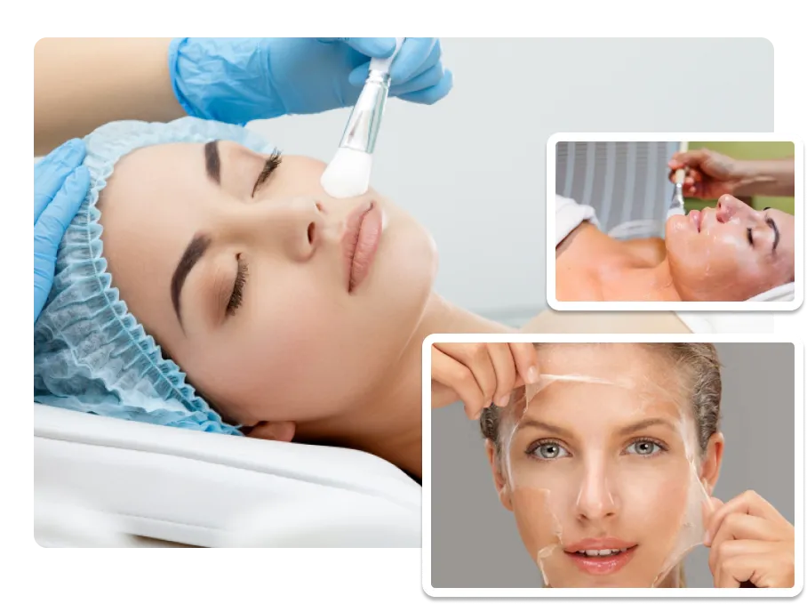 Skin Peeling Treatment_image 1