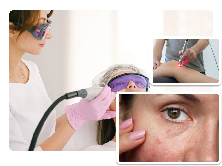 Vascular Lesion Removal_result