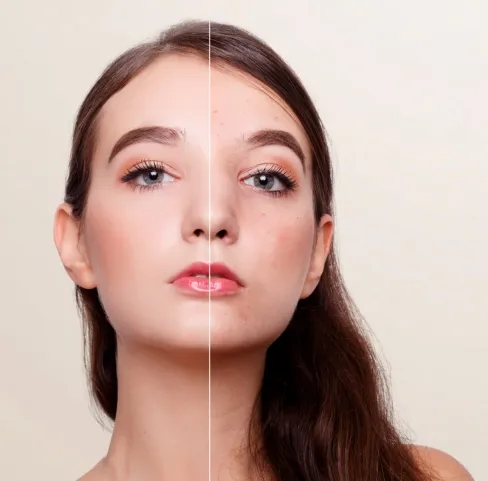 Advanced Laser Treatments