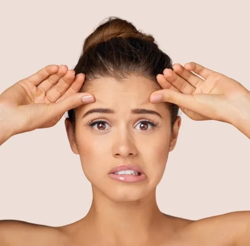 Gentle Chemical Peels