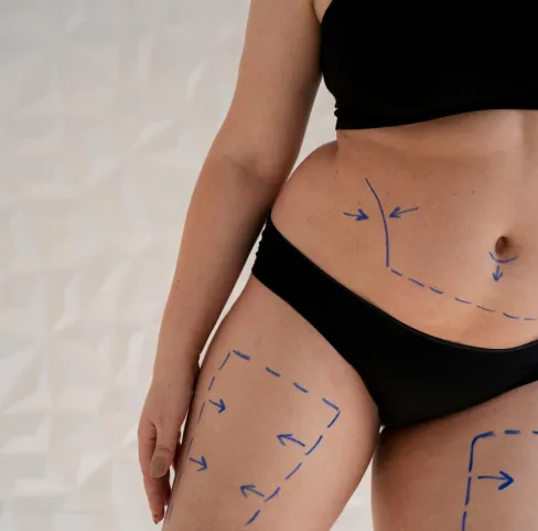 Reshape and tone your body with our advanced techniques for body contouring. Perfect for accentuating curves and defining your body's natural shape.