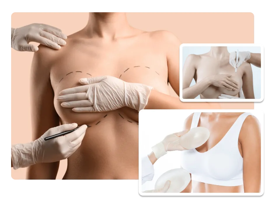 Breast Augmentation_result