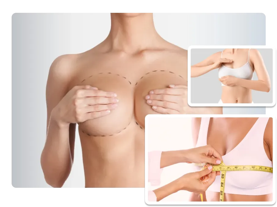 Breast Reduction_result