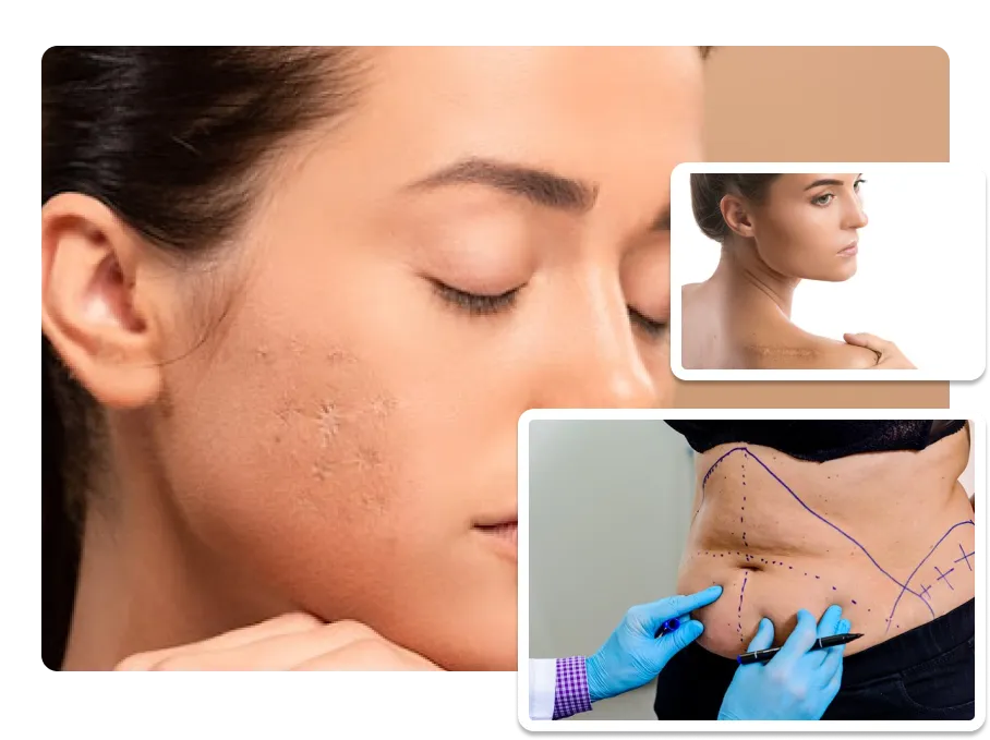 Scar revision surgeries_result