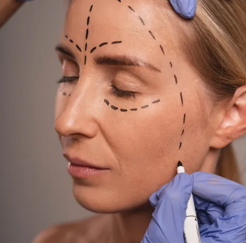 Tighten and lift sagging skin with our advanced facelift techniques. Bring back youthful contours and reduce signs of ageing for a smoother, firmer face.