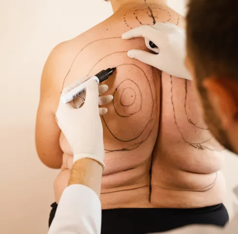 Customised Treatment Plans