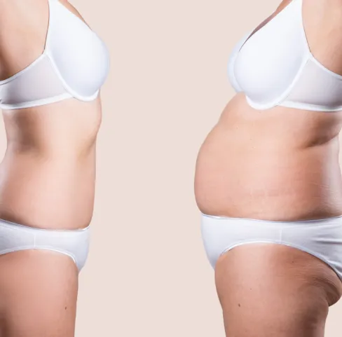 Support for Recovery and Aftercare