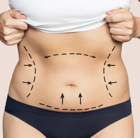 Safely and effectively remove stubborn fat pockets. Liposuction helps you sculpt your body, creating a more toned and proportioned look.