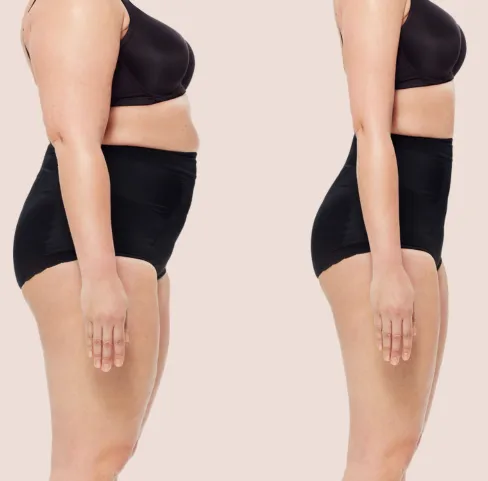 Recovery & Aftercare Support