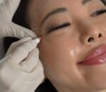 drifthikar clinic treatments pics_2