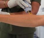 drifthikar clinic treatments pics_5