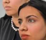 drifthikar clinic treatments pics_6