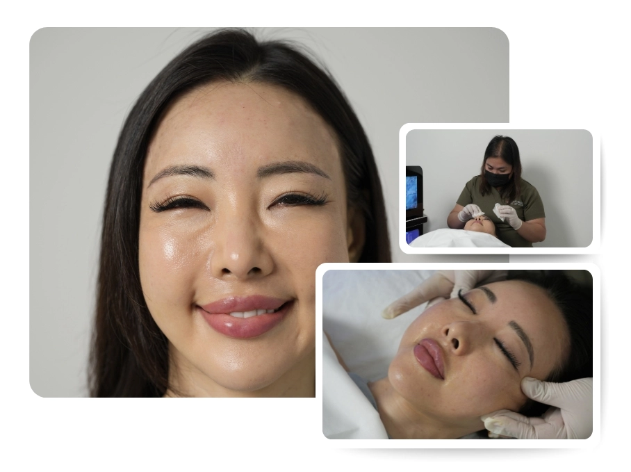 botox treatment in jumeirah