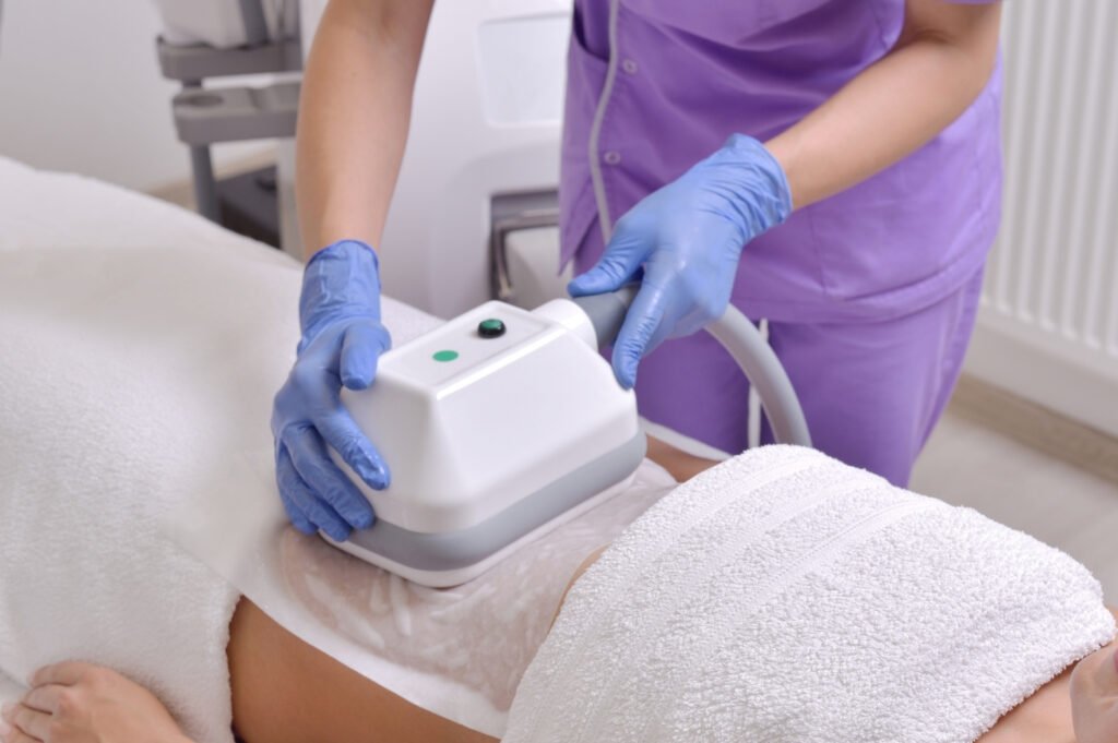 fat freezing near me