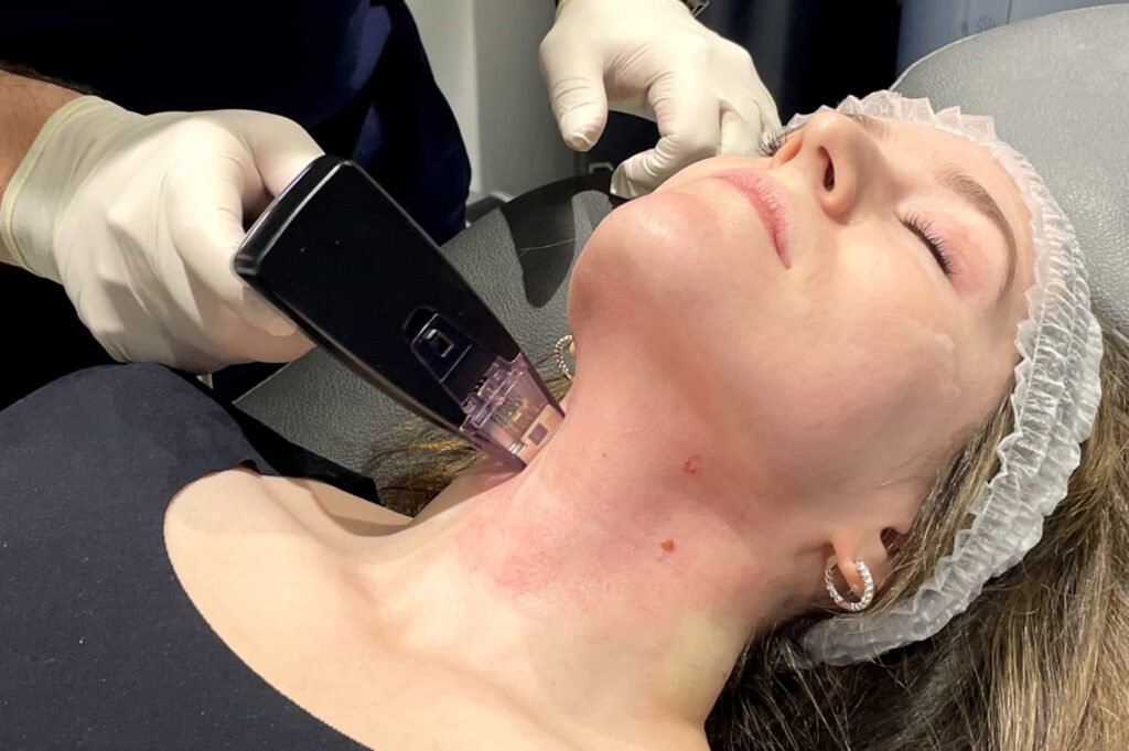 non surgical face lifting near me