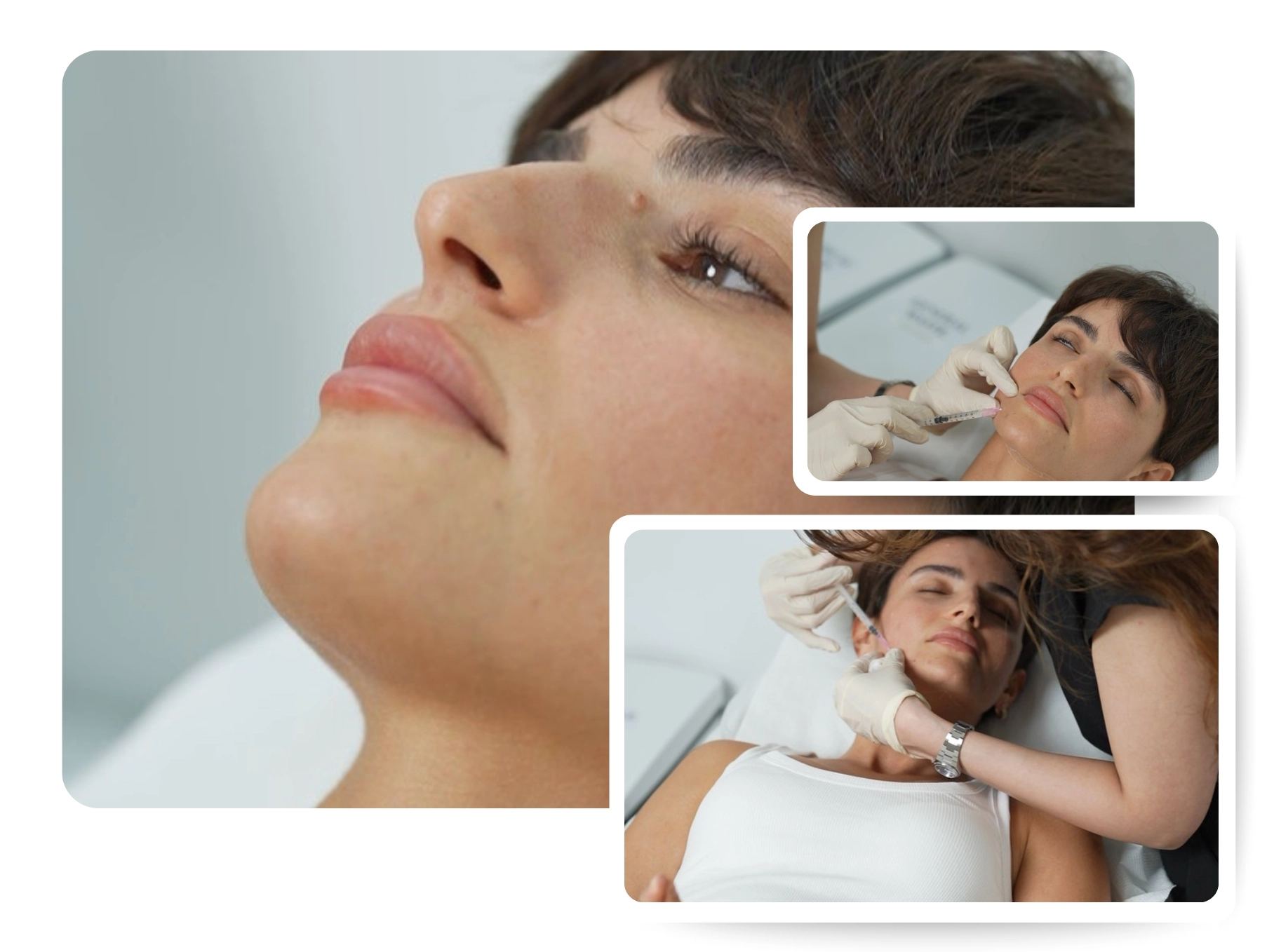 Jawline contouring_IMG