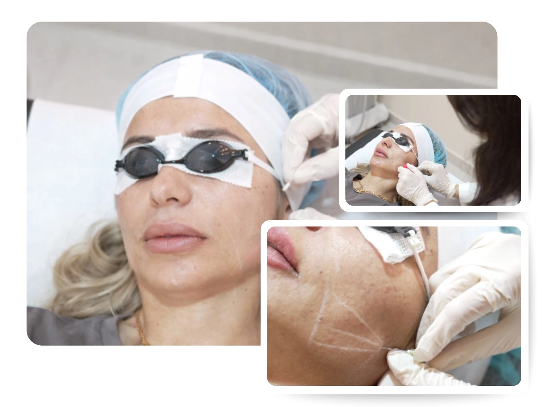 Skin Tightening Treatment_IMG