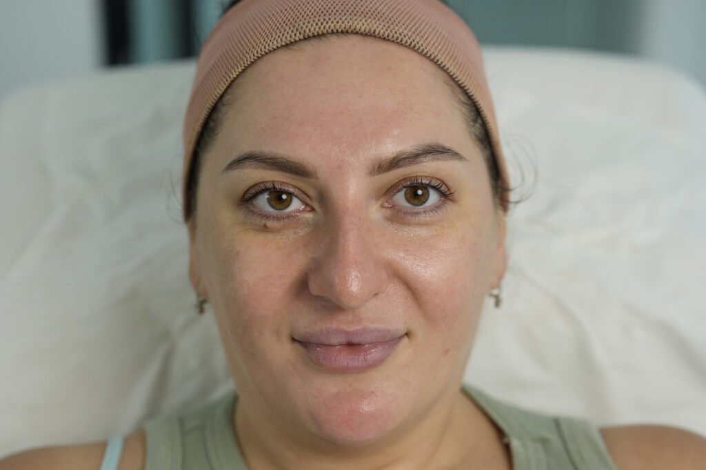 hydrafacial clinic in jumeirah