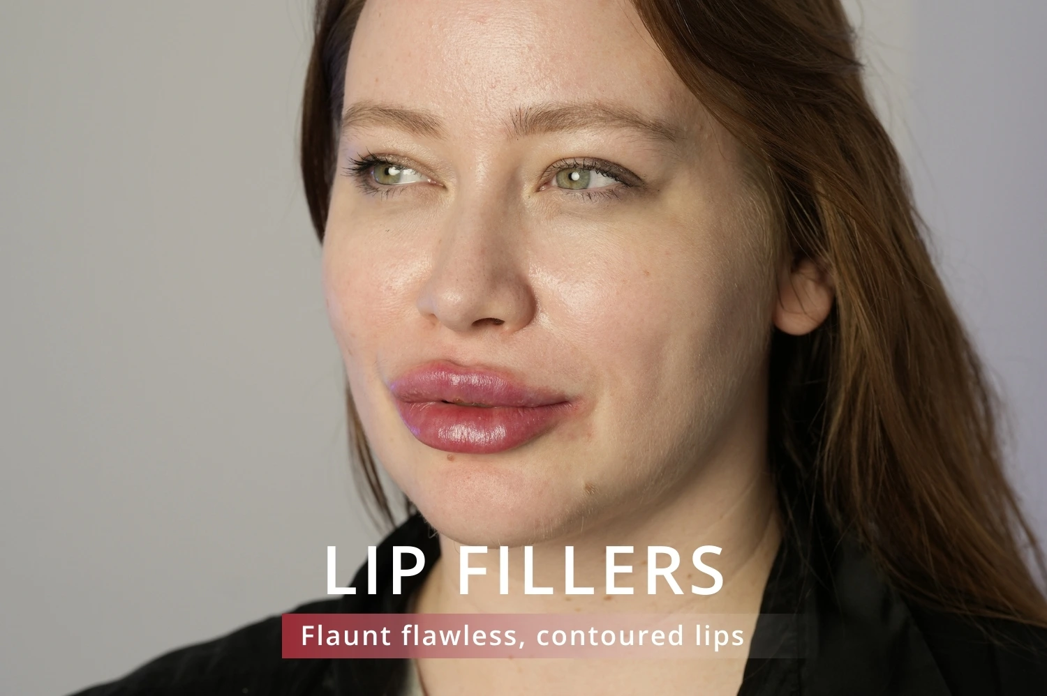 lip fillers in jumeirah