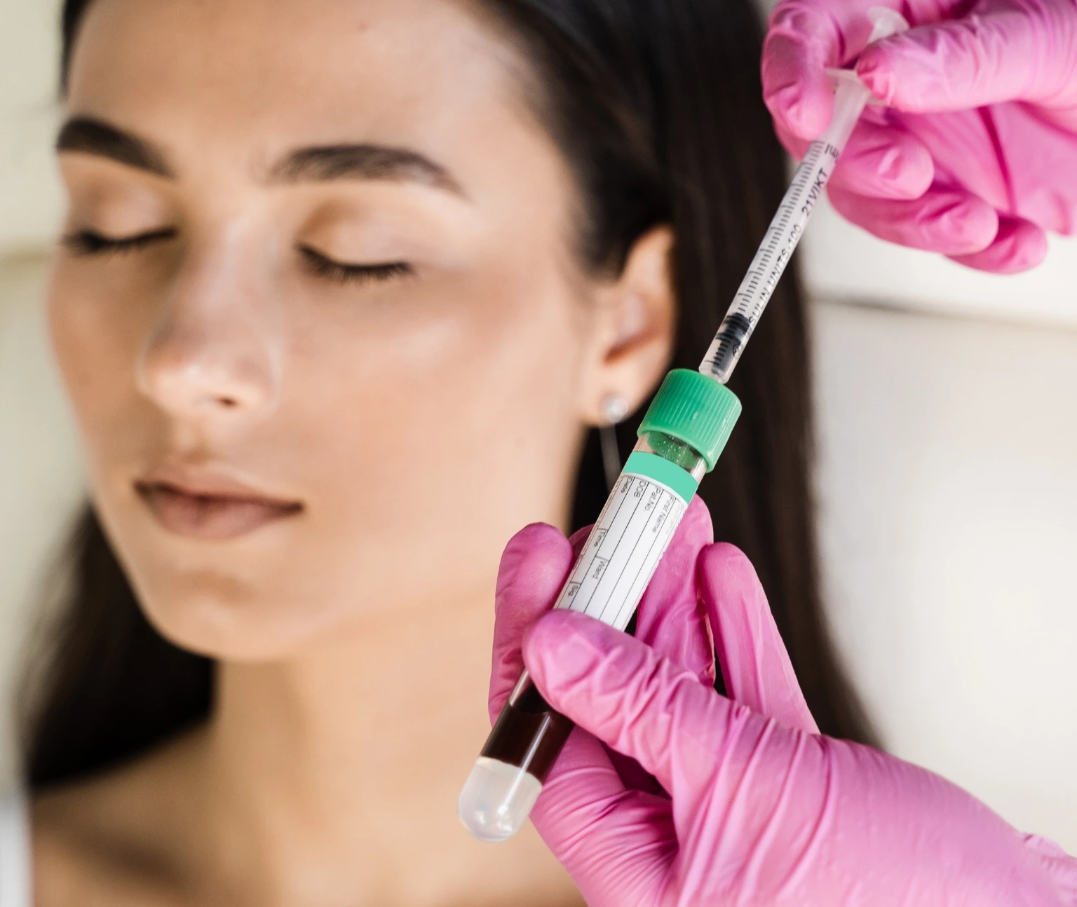 PRP For face in jumeirah PRP For face in jumeirah