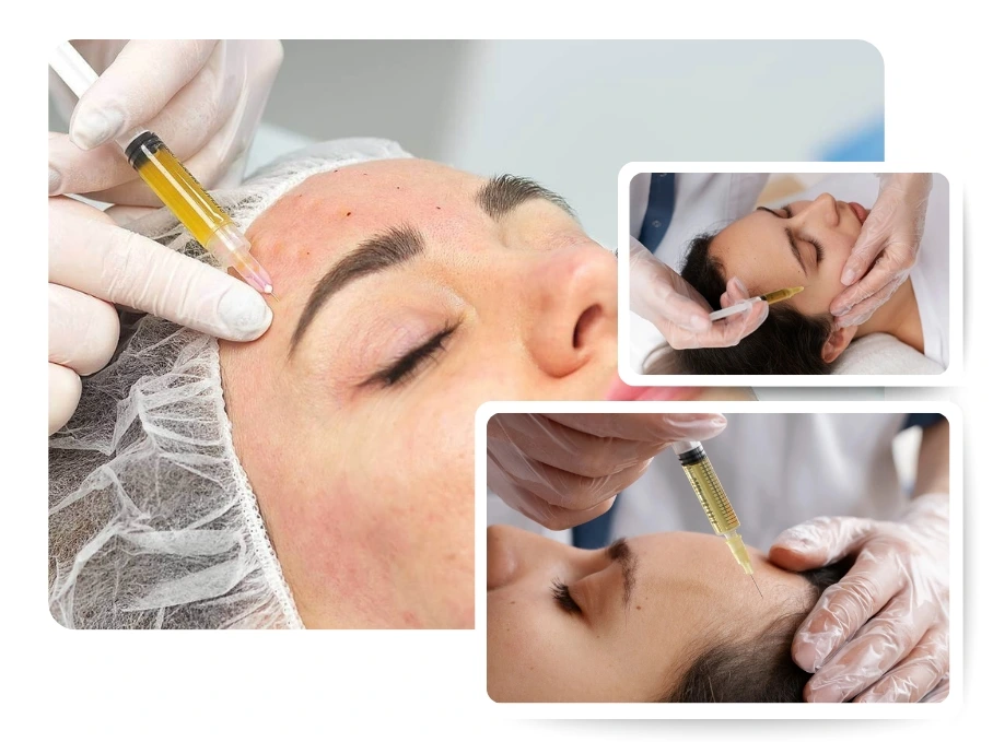 PRP for face in jumeirah