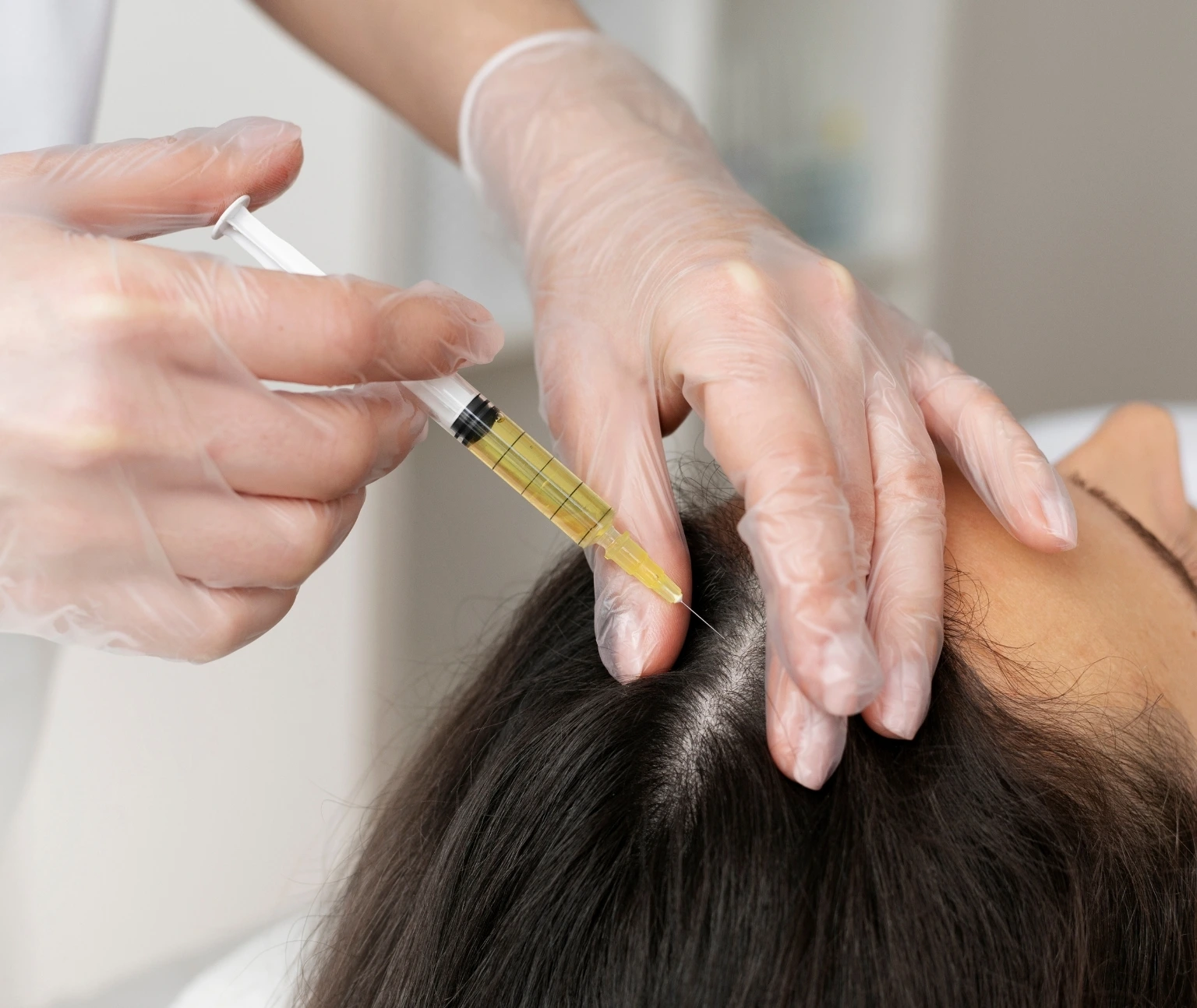 Stem cell hair therapy in jumeirah