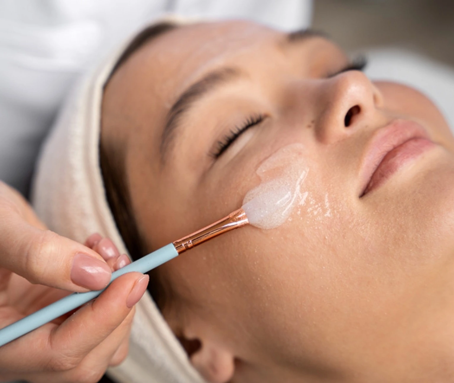 Chemical Peel Treatment in Jumeirah