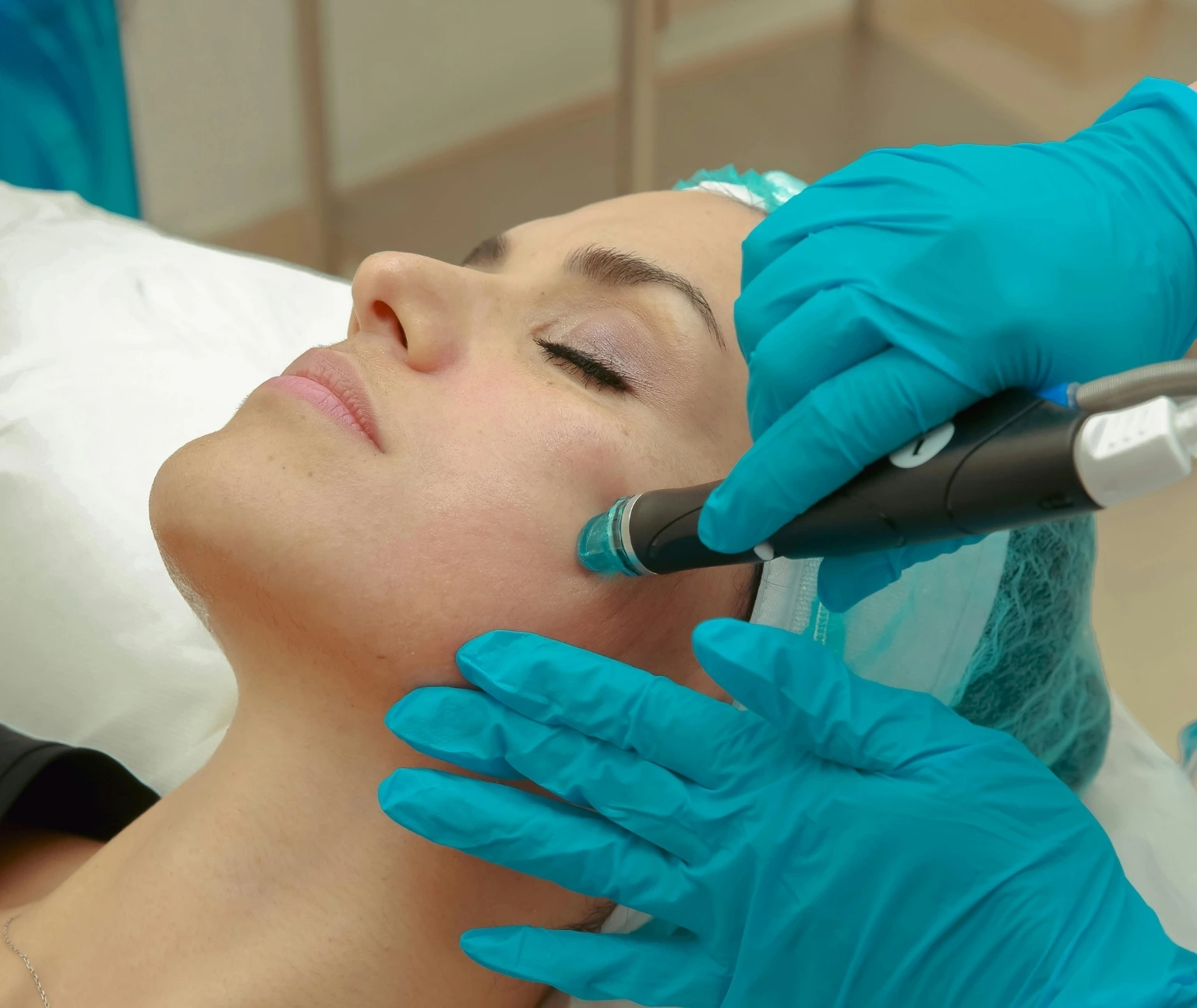 fractional CO2 laser in Jumeirah