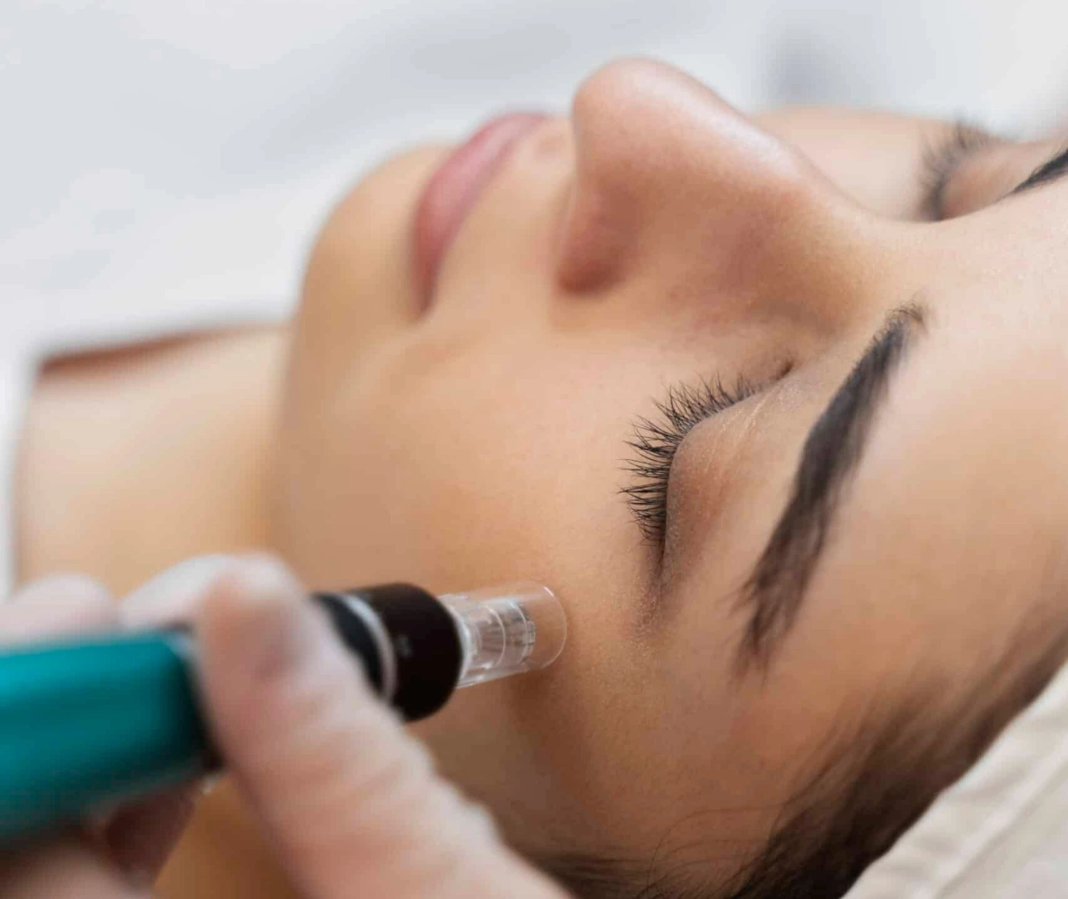 Derma Pen Treatment in Jumeirah