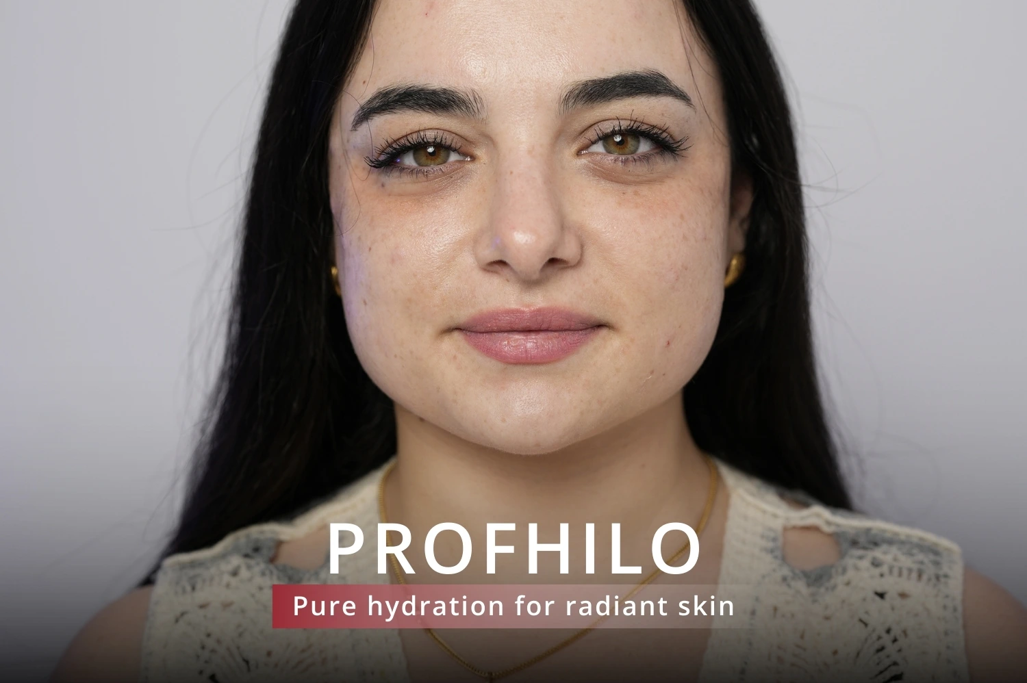 Profhilo treatment Jumeirah