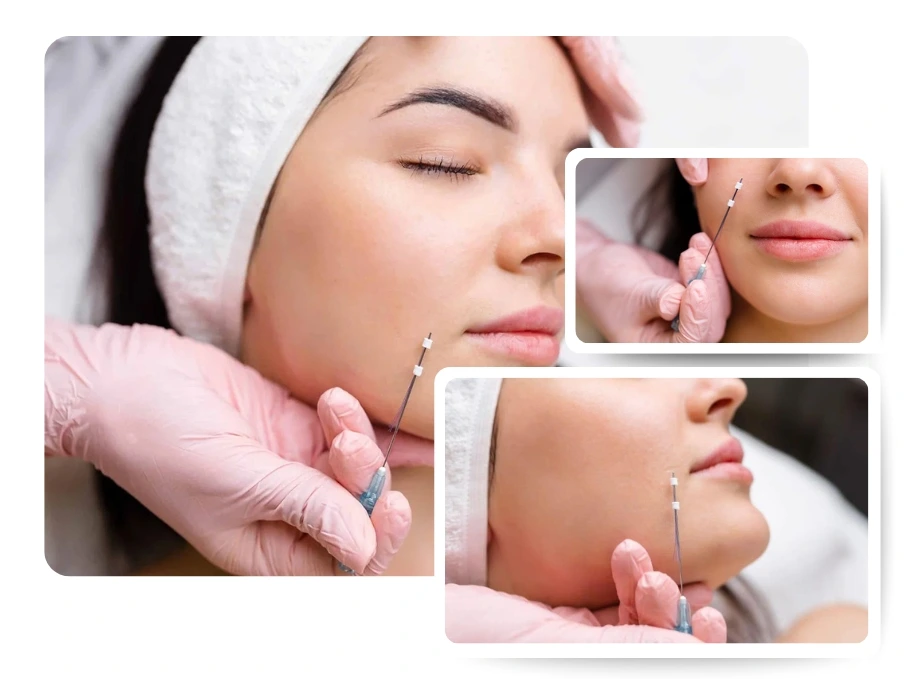 Thread lifting in jumeirah