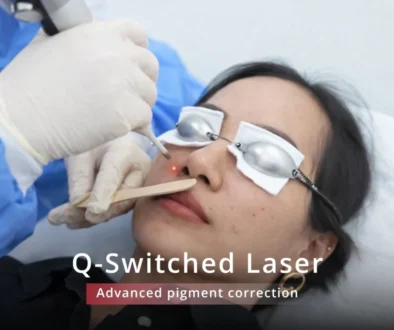 q switch laser in jumeirah