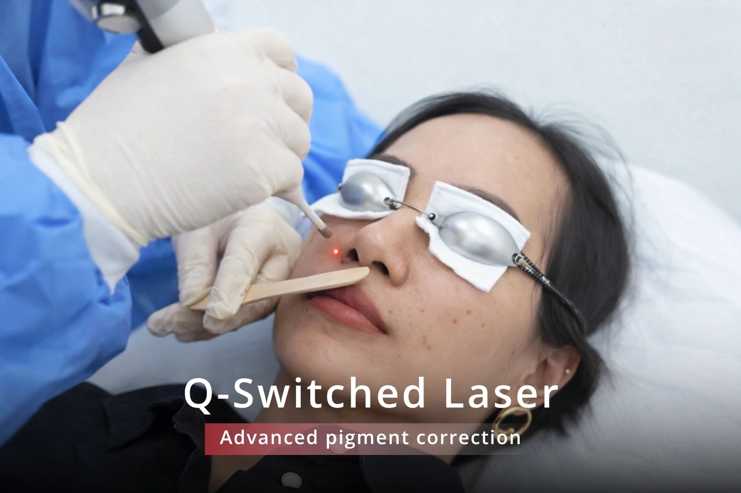 q switch laser in jumeirah