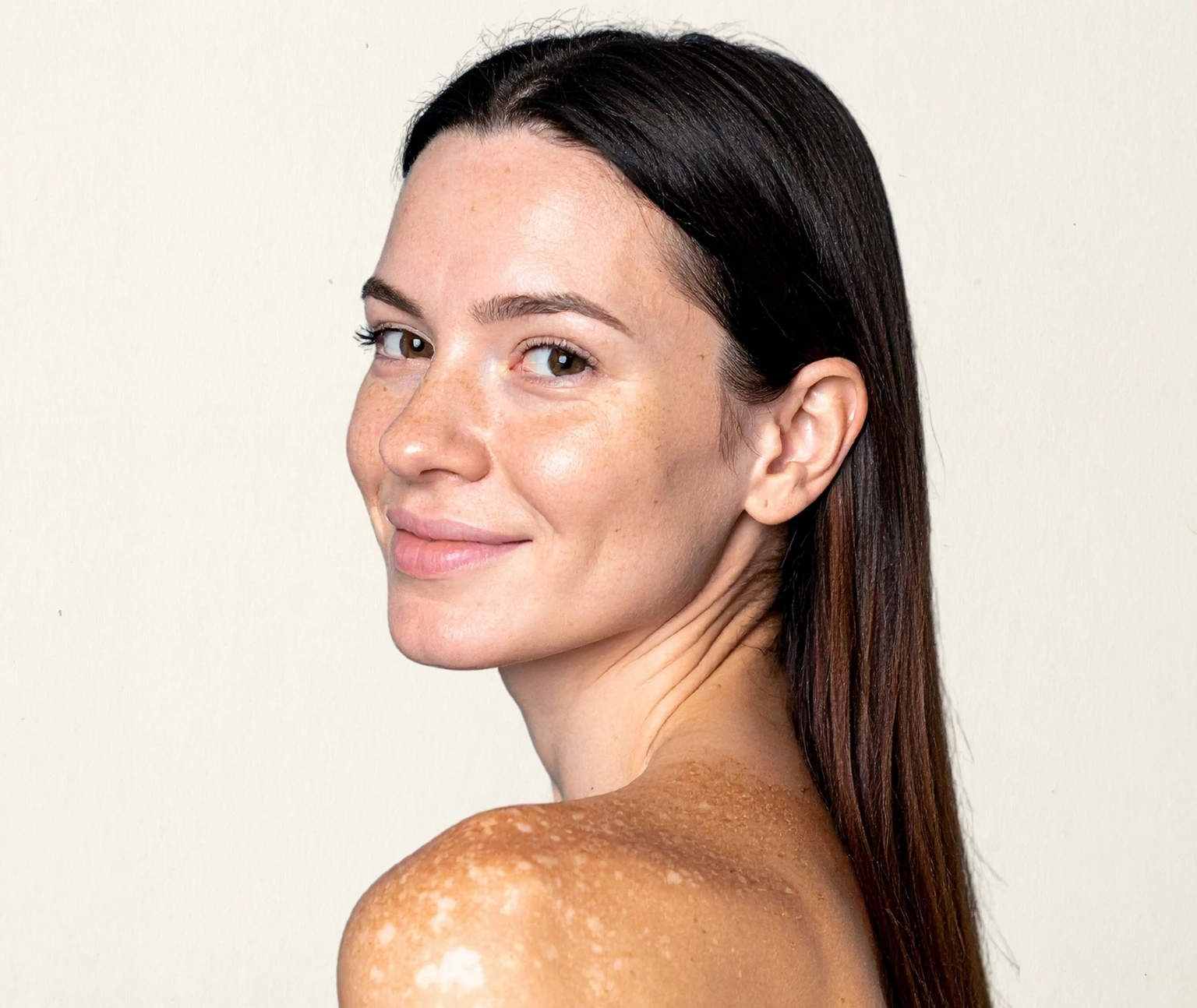 vitiligo treatment doctors in jumeirah