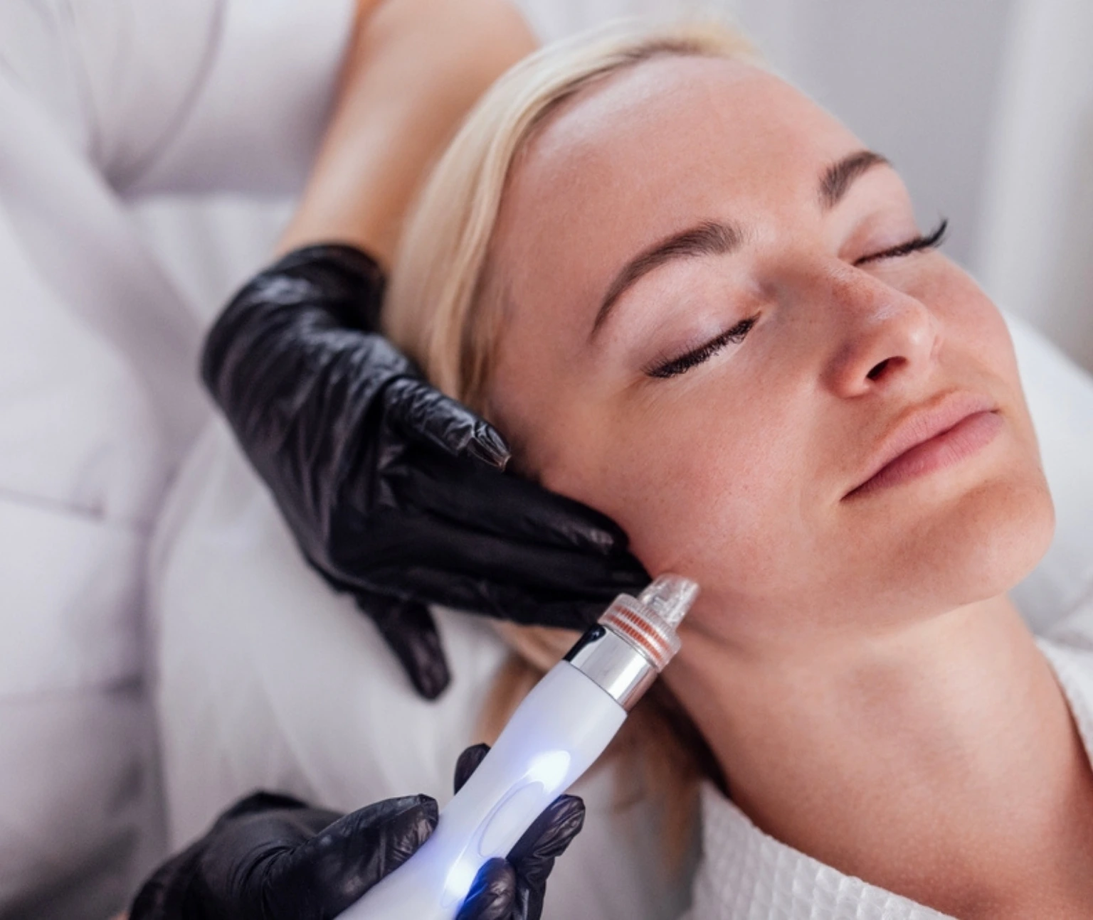 laser skin resurfacing in jumeirah