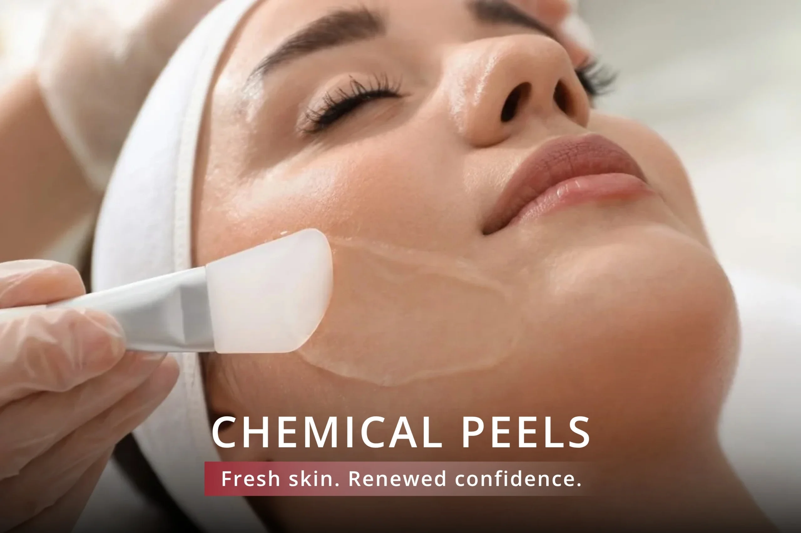 chemical peel treatment jumeirah