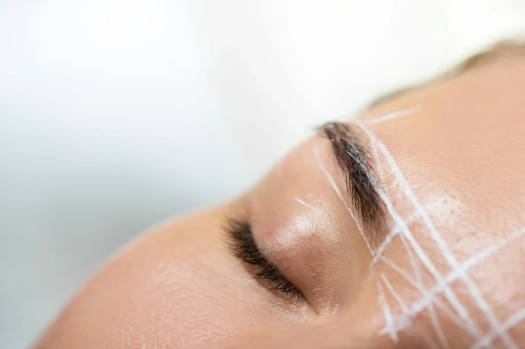 botox brow lift jumeirah 