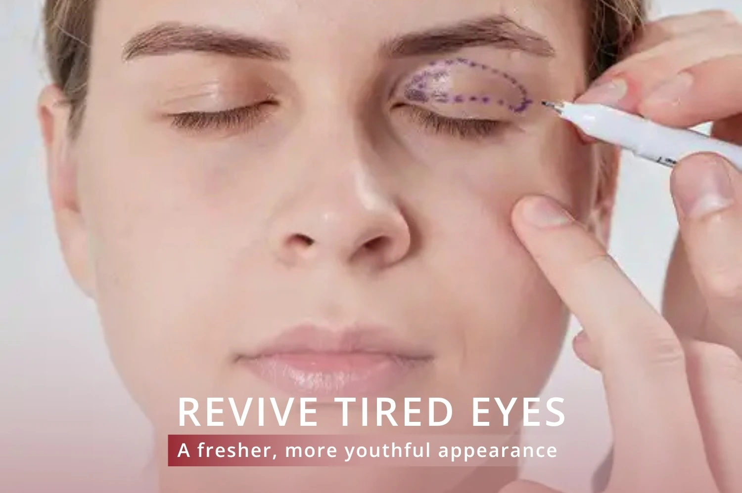 eyelid surgery in Jumeirah