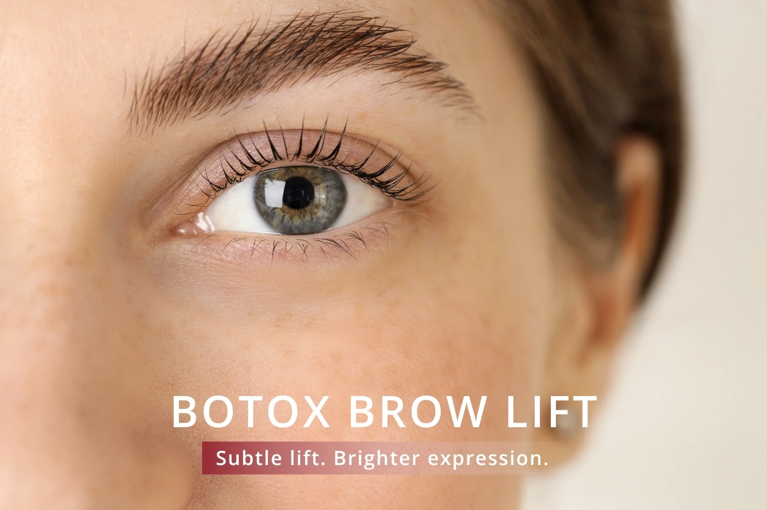 botox brow lift jumeirah