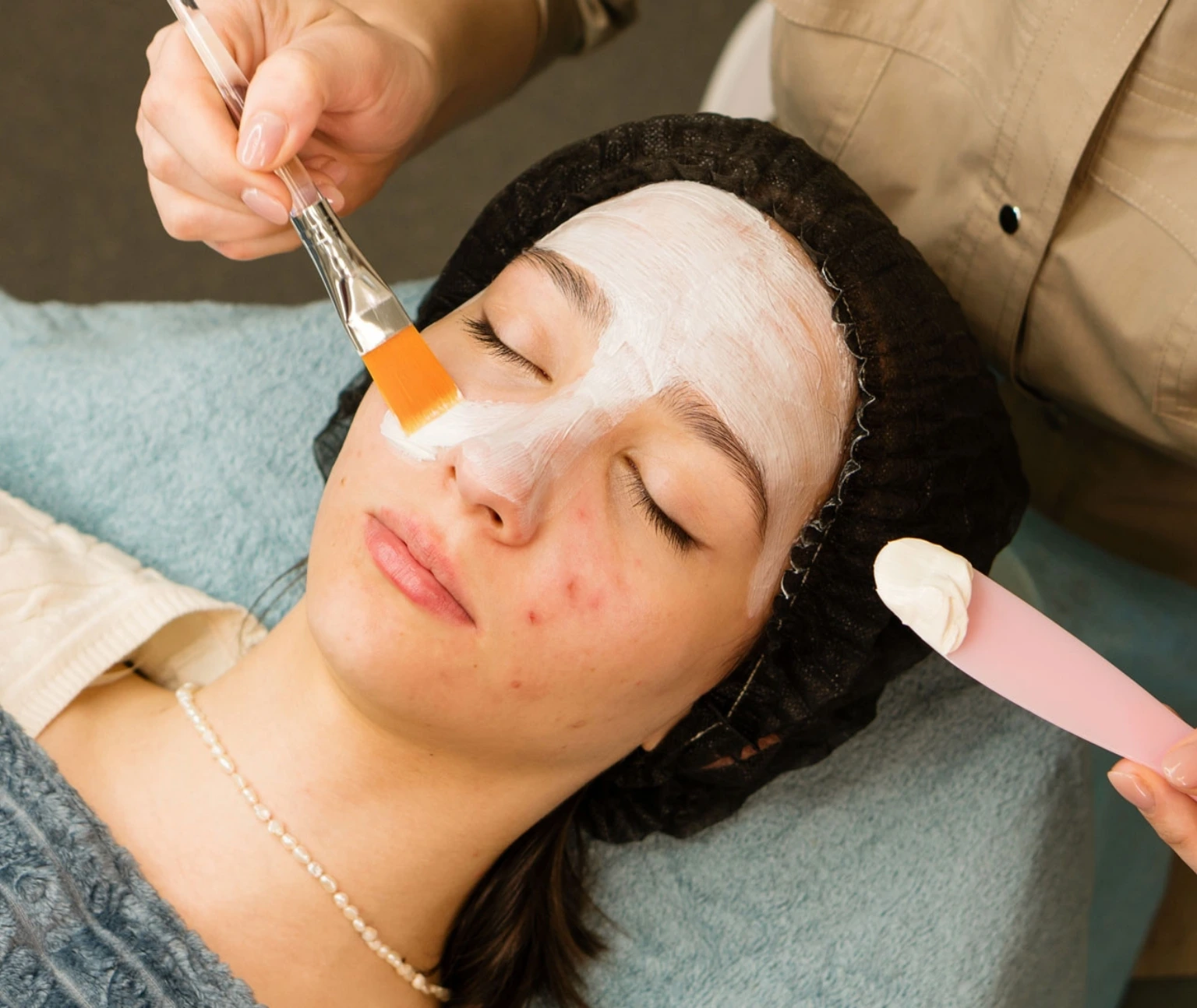 acne facial treatment in jumeirah
